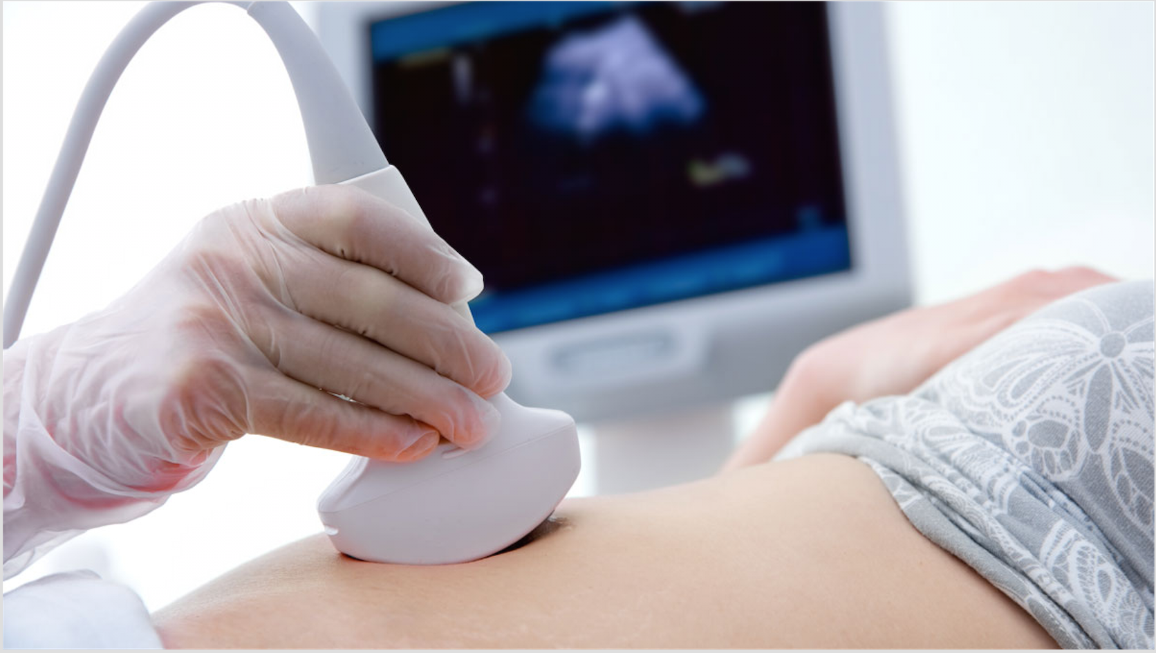 Diagnostic Medical Sonography - Mandl School: The College of Allied Health